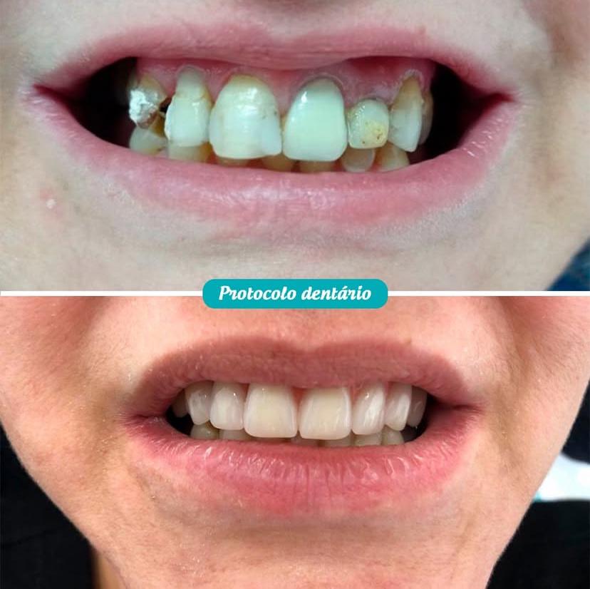 Dentário